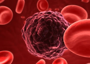 Link Between Cancer and Obesity