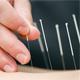 Does Acupuncture for Weight Loss Work?