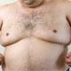 How to Get Rid of Man Boobs?