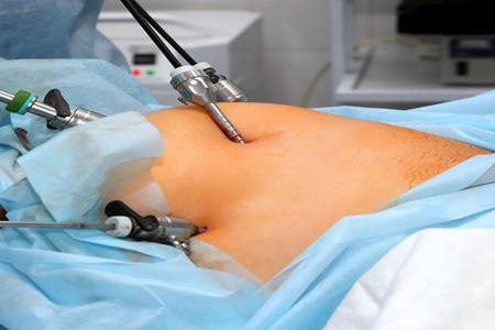 Weight Loss Surgery: A Risky Solution